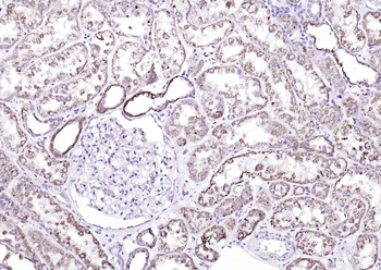 Fumarase/FH Mouse Monoclonal Antibody