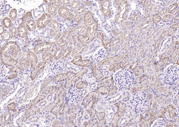 Cathepsin L Rabbit Polyclonal Antibody