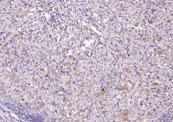 Cathepsin L Rabbit Polyclonal Antibody