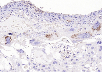 Cathepsin L Rabbit Polyclonal Antibody