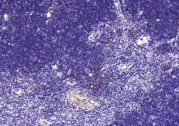 Cathepsin L Rabbit Polyclonal Antibody