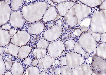 Cathepsin L Rabbit Polyclonal Antibody