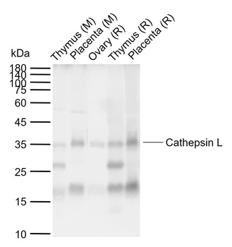Cathepsin L antibody