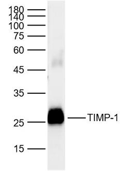 TIMP-1 Rabbit Polyclonal Antibody
