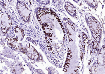 NGAL Rabbit Polyclonal Antibody