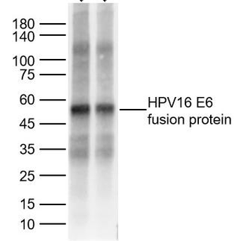 HPV16 E6 Rabbit Polyclonal Antibody