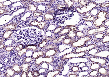 BHMT Rabbit Polyclonal Antibody