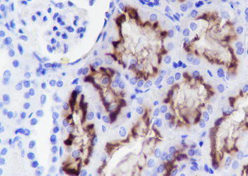 CD13 Recombinant Rabbit Monoclonal Antibody