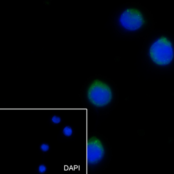 CD13 Recombinant Rabbit Monoclonal Antibody