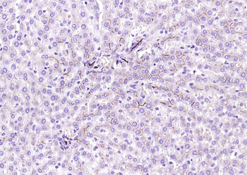 CD13 Recombinant Rabbit Monoclonal Antibody