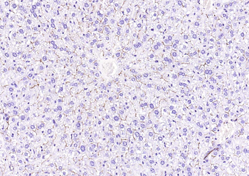 CD13 Recombinant Rabbit Monoclonal Antibody