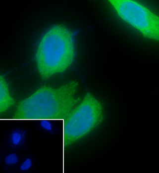 Keratin 6 Recombinant Rabbit Monoclonal Antibody
