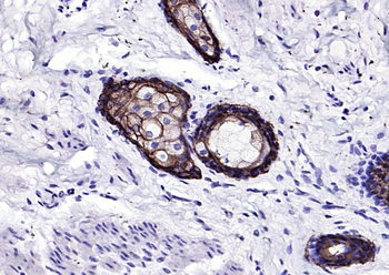 Keratin 6 Recombinant Rabbit Monoclonal Antibody