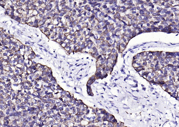 Keratin 6 Recombinant Rabbit Monoclonal Antibody