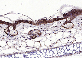 Keratin 6 Recombinant Rabbit Monoclonal Antibody