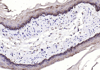 Keratin 6 Recombinant Rabbit Monoclonal Antibody