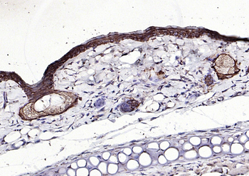 Keratin 6 Recombinant Rabbit Monoclonal Antibody