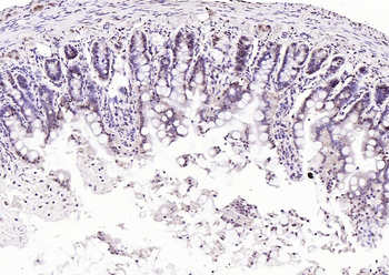 SPHK2 Mouse Monoclonal Antibody