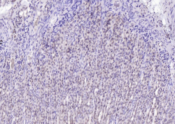 SPHK2 Mouse Monoclonal Antibody