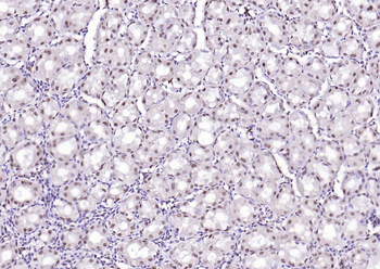 SPHK2 Mouse Monoclonal Antibody