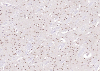 SPHK2 Mouse Monoclonal Antibody