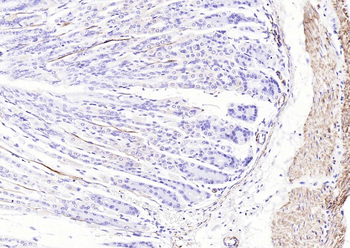 Desmin Recombinant Rabbit Monoclonal Antibody