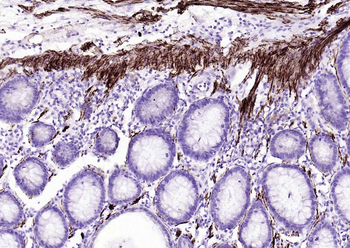 Desmin Recombinant Rabbit Monoclonal Antibody