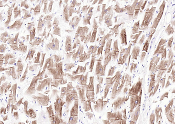 Desmin Recombinant Rabbit Monoclonal Antibody