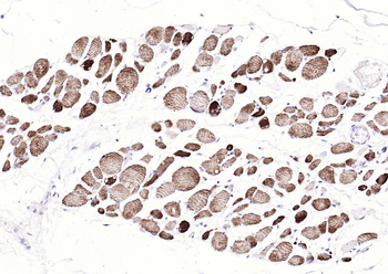 Desmin Recombinant Rabbit Monoclonal Antibody