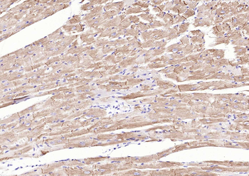 Desmin Recombinant Rabbit Monoclonal Antibody
