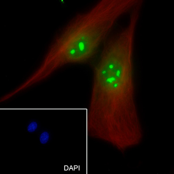 Nucleophosmin Recombinant Rabbit Monoclonal Antibody