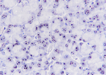 Nucleophosmin Recombinant Rabbit Monoclonal Antibody