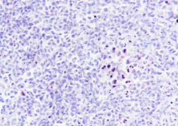 Nucleophosmin Recombinant Rabbit Monoclonal Antibody