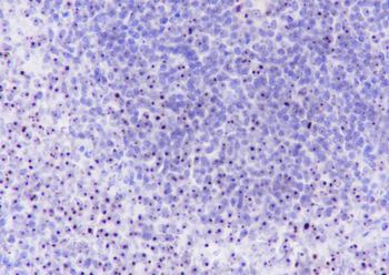 Nucleophosmin Recombinant Rabbit Monoclonal Antibody