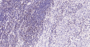 CD3E Recombinant Rabbit Monoclonal Antibody