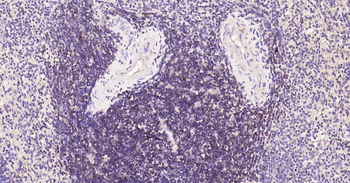 CD3E Recombinant Rabbit Monoclonal Antibody