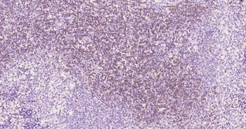 CD3E Recombinant Rabbit Monoclonal Antibody