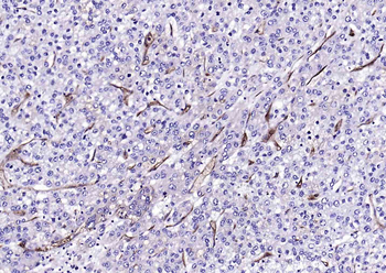 CD59 Recombinant Rabbit Monoclonal Antibody