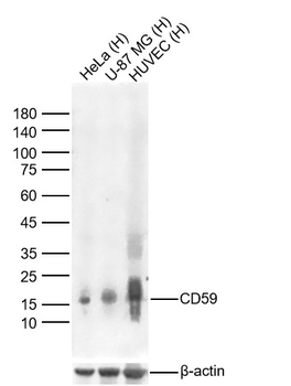 CD59 Recombinant Rabbit Monoclonal Antibody