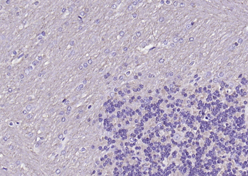 SNAP25 Recombinant Mouse Monoclonal Antibody