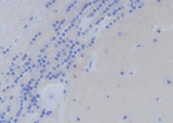 SNAP25 Recombinant Mouse Monoclonal Antibody