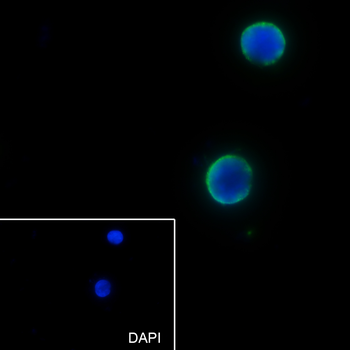 GSTP1 Recombinant Rabbit Monoclonal Antibody