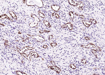 GSTP1 Recombinant Rabbit Monoclonal Antibody