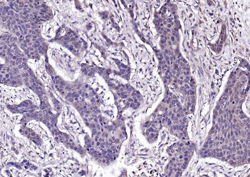 GSTP1 Recombinant Rabbit Monoclonal Antibody