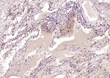 GSTP1 Recombinant Rabbit Monoclonal Antibody