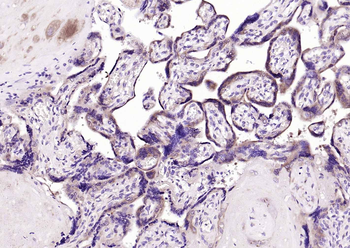 GSTP1 Recombinant Rabbit Monoclonal Antibody