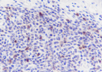 CD79b Recombinant Rabbit Monoclonal Antibody