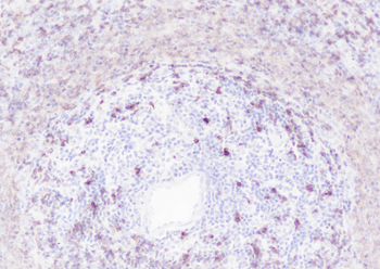 CD79b Recombinant Rabbit Monoclonal Antibody