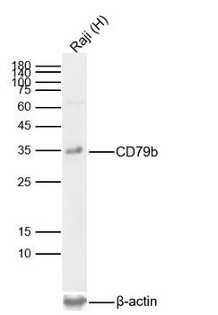 CD79b antibody