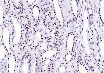 XRCC5/Ku80 Recombinant Rabbit Monoclonal Antibody
